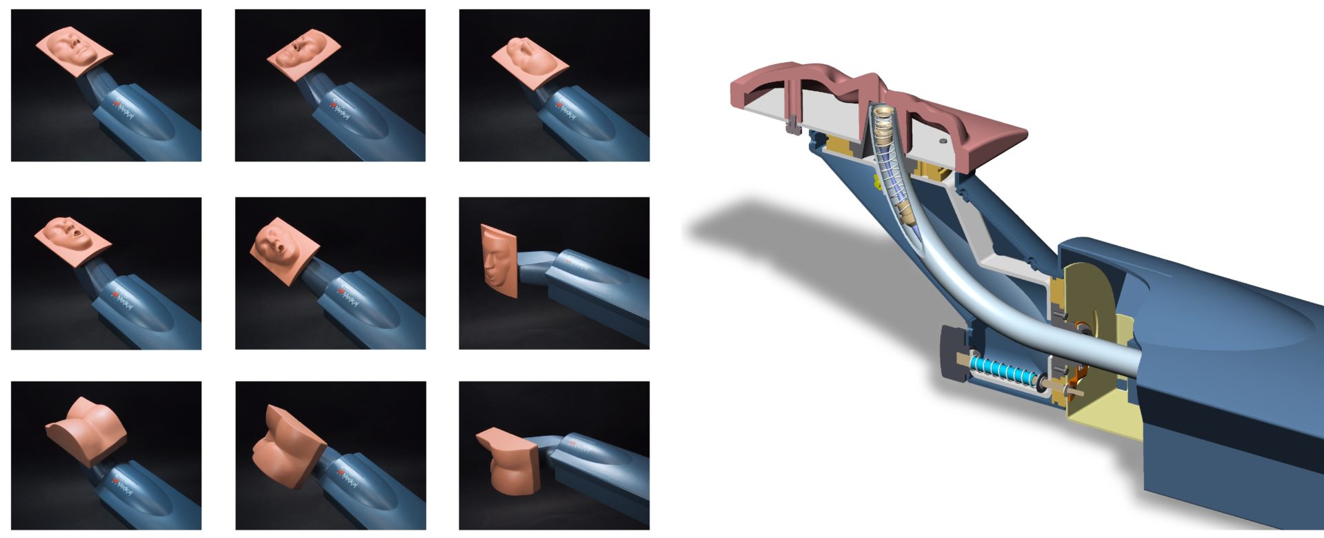 Pre-Op Endoscopy Simulator