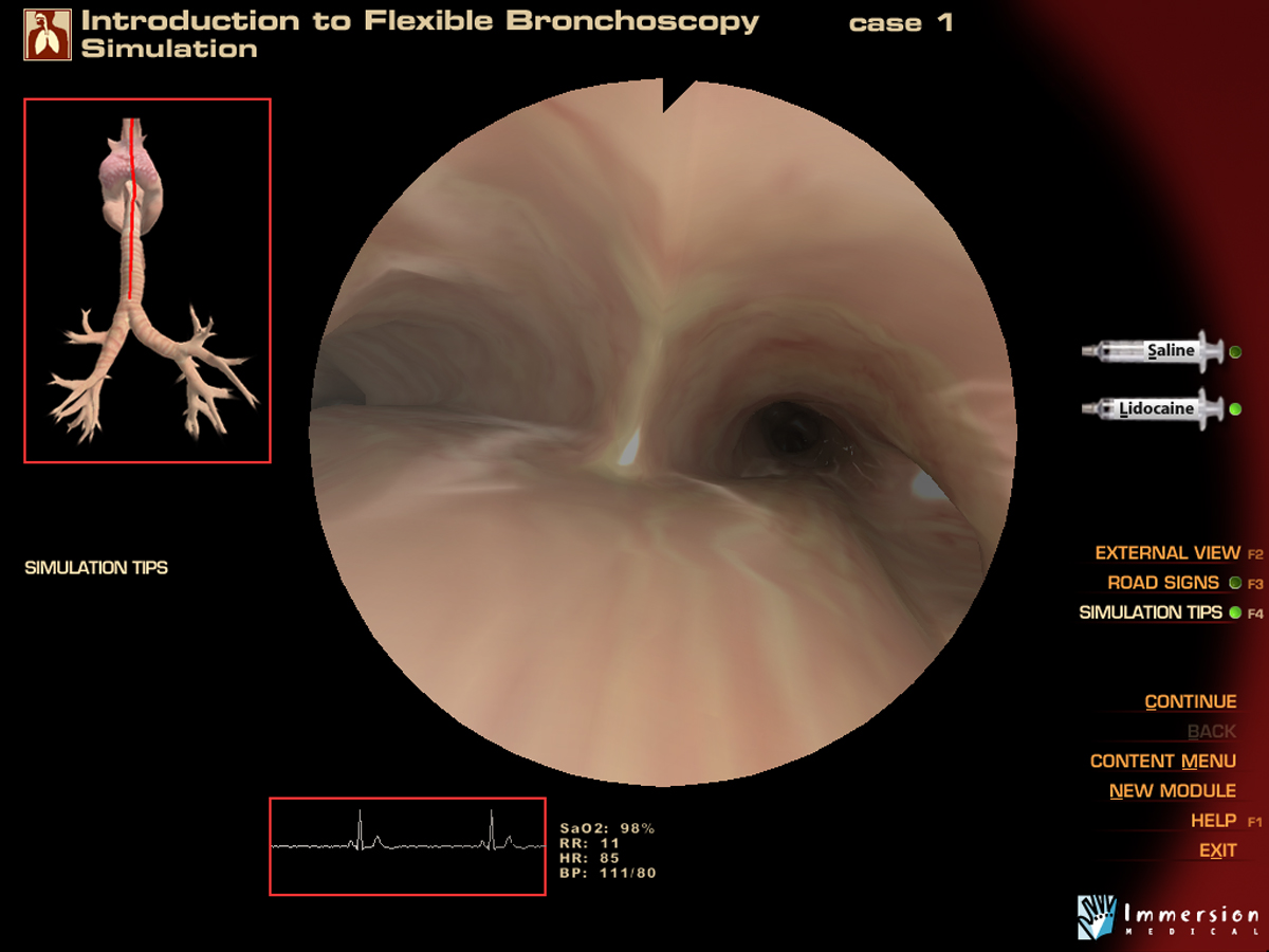 Pre-Op Endoscopy Simulator